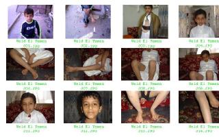 Yemen Boys Feet Contact Sheets